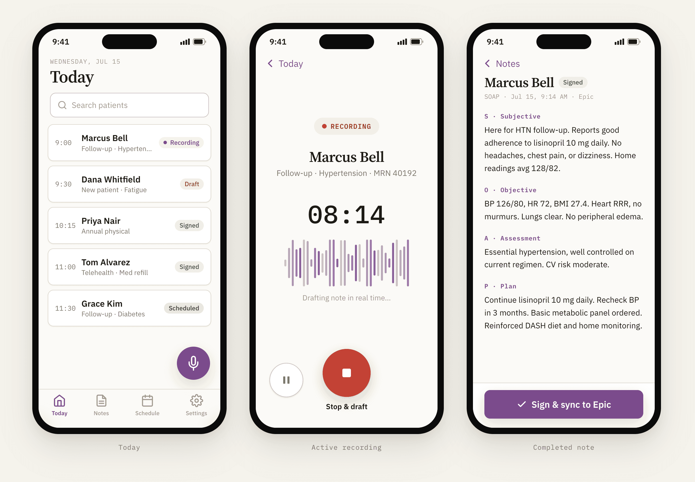 NoteV mobile app workflow — patient list, active recording with waveform, and completed SOAP note with Sign & sync to Epic